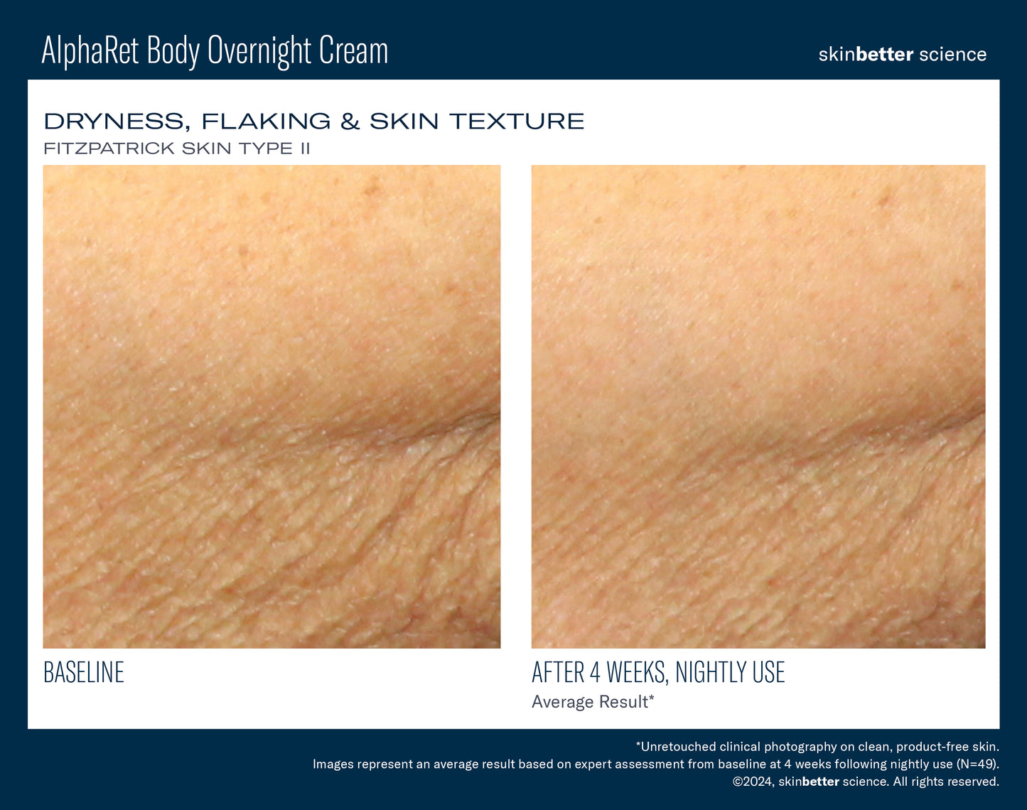 AlphaRet Body Overnight Cream 150ml