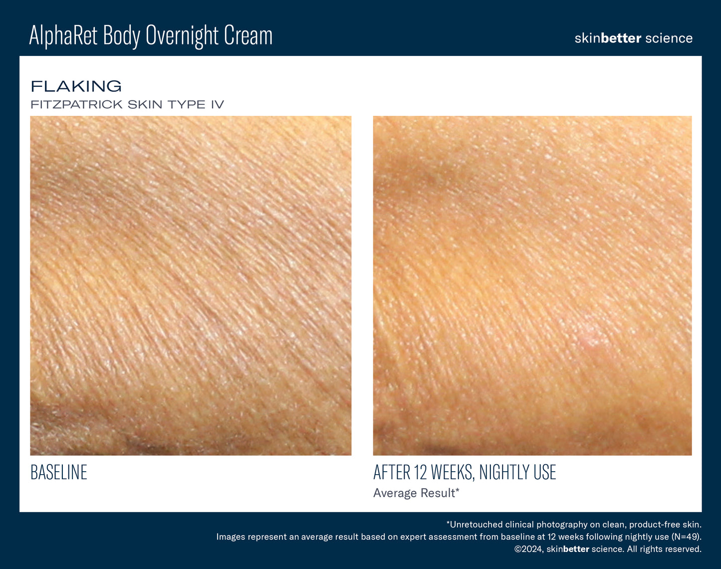 AlphaRet Body Overnight Cream 150ml