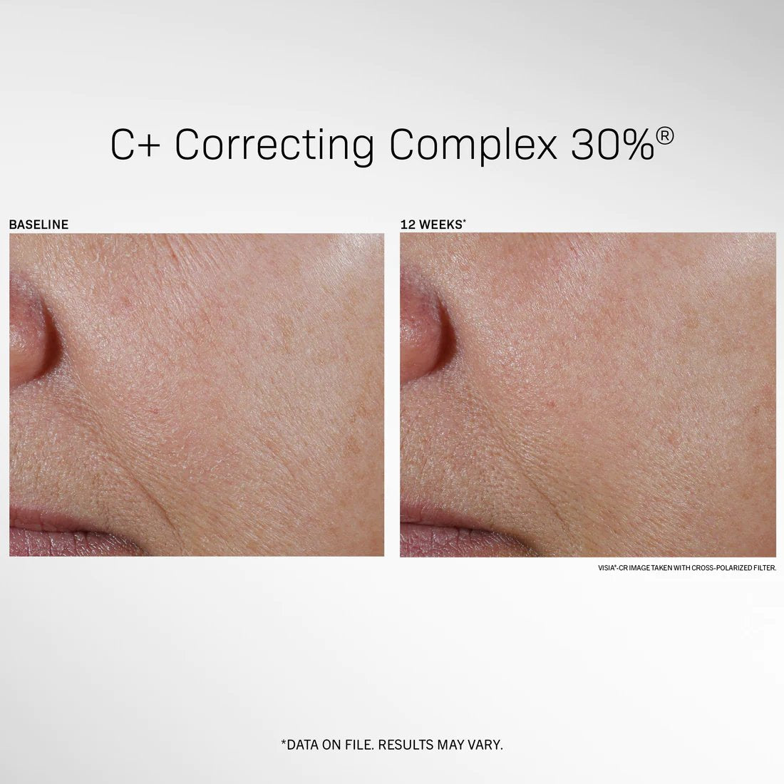 C+ Correcting Complex 30%