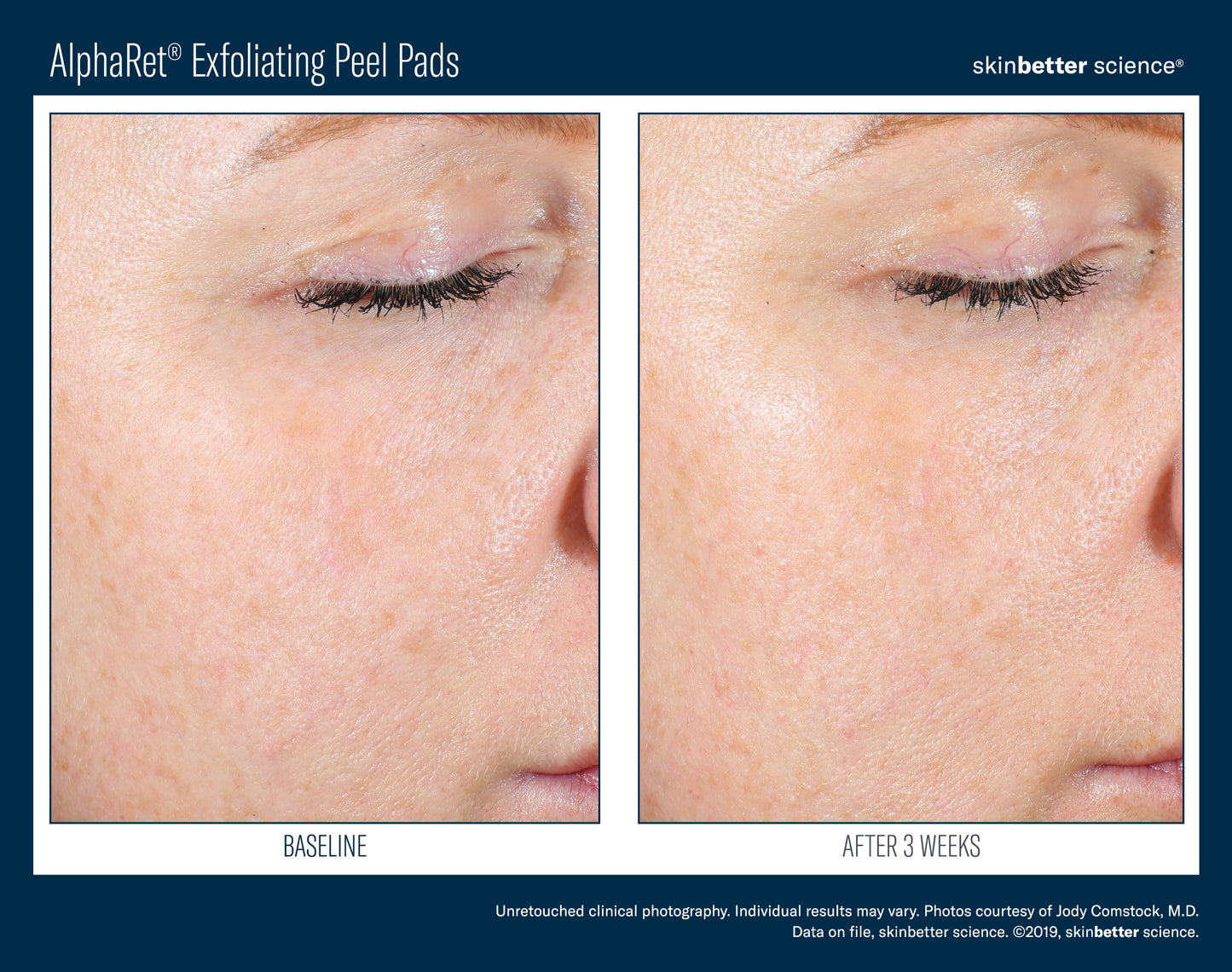 AlphaRet Exfoliating Peel Pads 30count