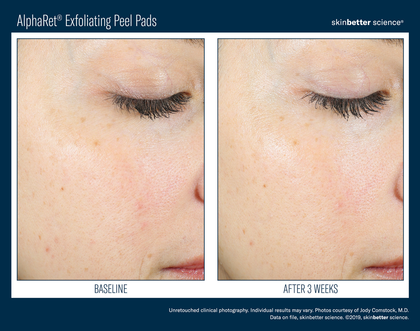 AlphaRet Exfoliating Peel Pads 30count