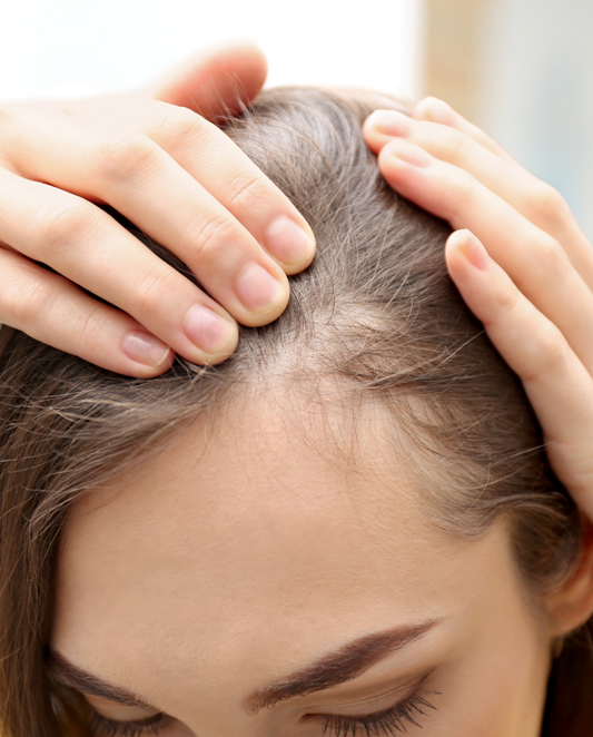 3 Month Hair Restoration Bootcamp