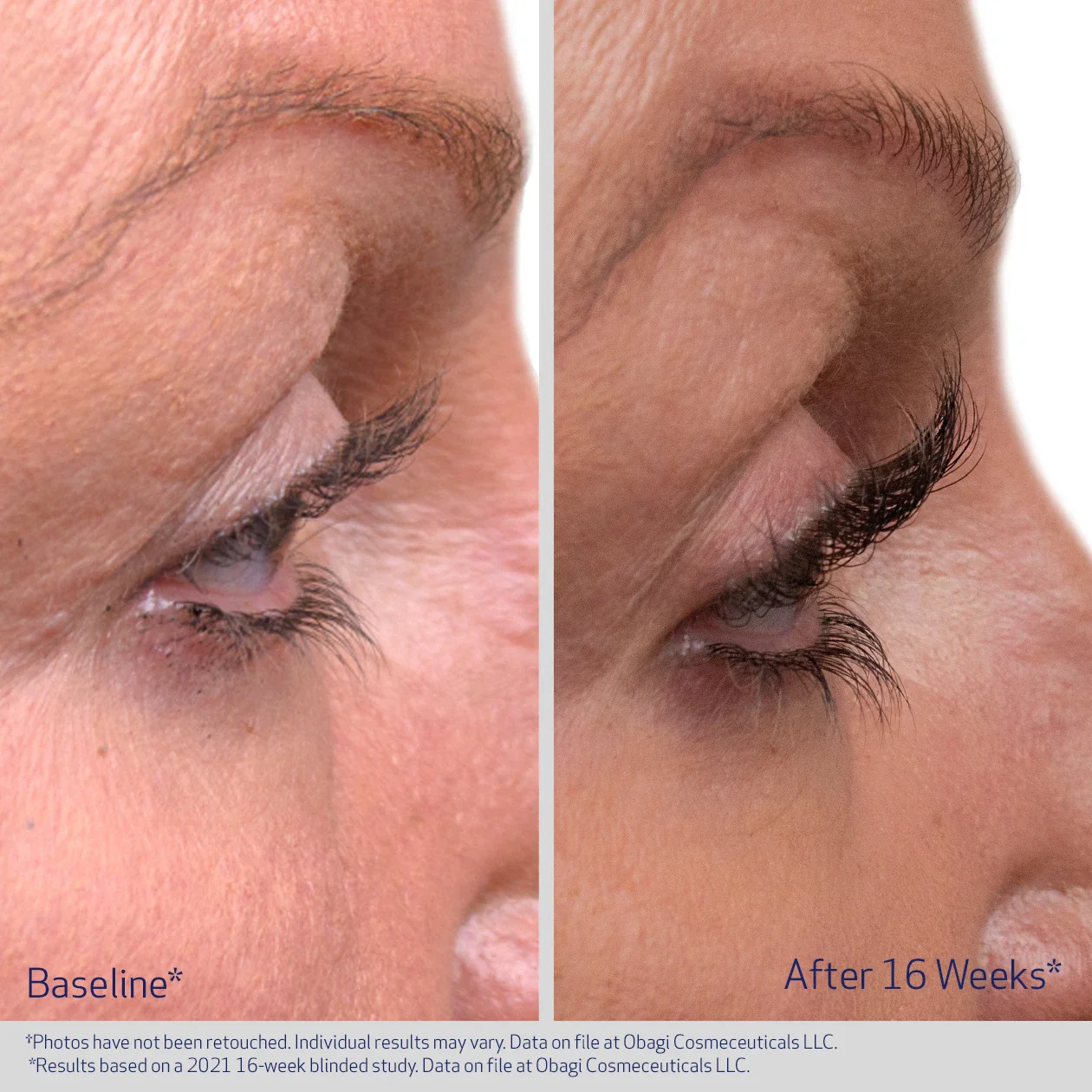 Obagi NU-CIL Eyelash Enhancing Serum
